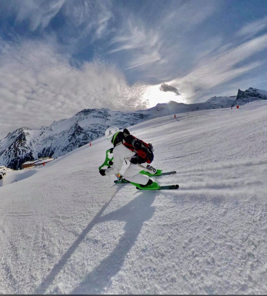 Knee – the most common ski injury – we have a 100% cure for it.